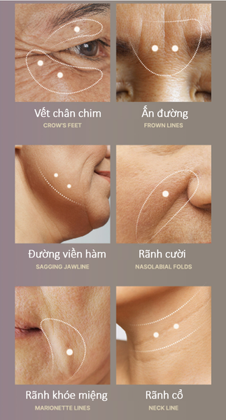  Tinh chất Deep Vita A Retinol Serum 30ml [Date 8/2026] 