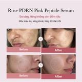  Tinh chất PDRN Pink Peptide Serum 30ml 