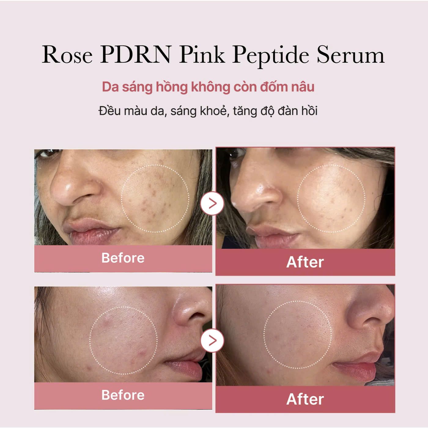  Tinh chất sáng da, săn chắc PDRN Pink Peptide Serum 30ml 