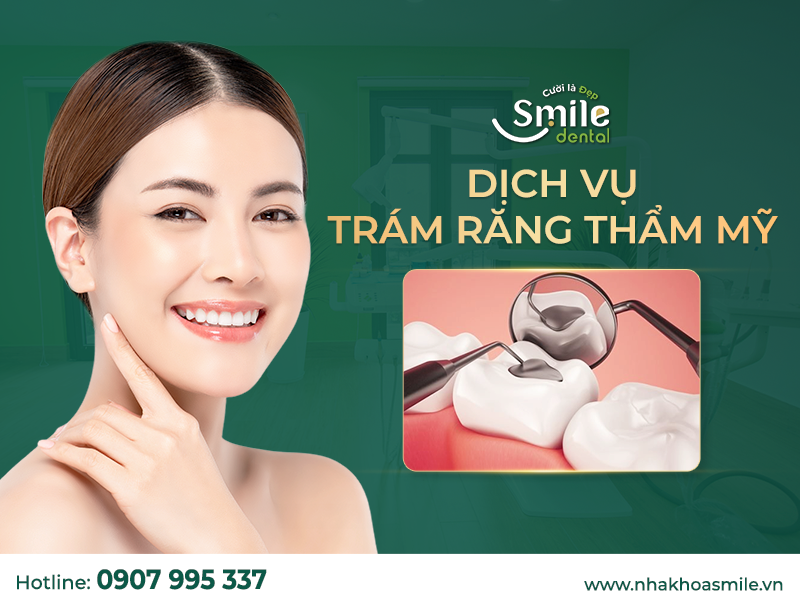 Trám răng thẩm mỹ xoang lớn