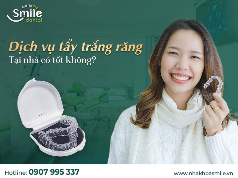 Tẩy trắng răng tại nhà