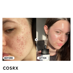 Cosrx The Niacinamide 15 Serum