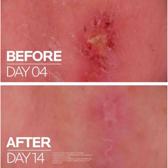 La roche-posay Kem Dưỡng 40ml - Mẫu Mới