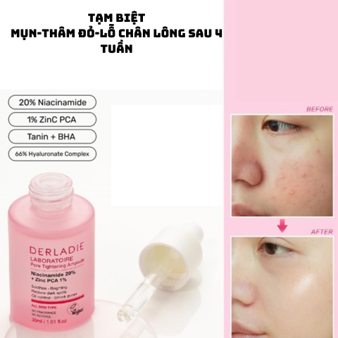 SERUM DERLADIE GIẢM MỤN, MỜ THÂM ĐỎ VÀ THU NHỎ LỖ CHÂN LÔNG DERLADIE LABORATOIRE PORE TIGHTENING AMPOULE NIACINAMIDE 20% + ZINC PCA 1% 30ml