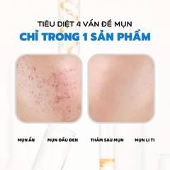 Gel giảm mụn Actidem Derma Gel 40G