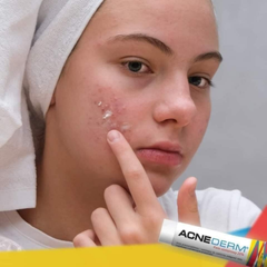 Acne-Derm Kwas Azelainowy 20% 20g