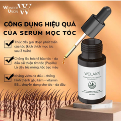 Tinh Chất Dưỡng & Kích Thích Mọc Tóc Weilaiya Ginger Hair Root Nourishing Essence (1 chai)