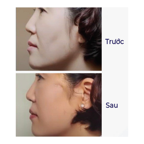  JBP VLINE - PREMIUM 
