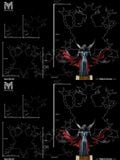  Apocalymon - Digimon - MINE Studio 