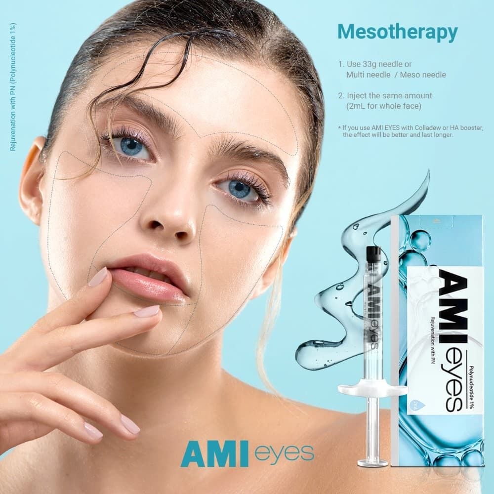  TIÊM TRỊ THÂM MẮT AMI EYES 