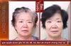 Hà thủ ô khô loại 1 chưa chế đỗ đen
