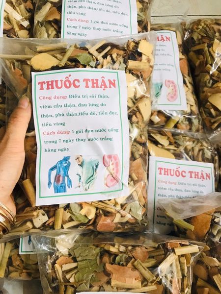 6 thang Thuốc Nam điều trị sỏi thận
