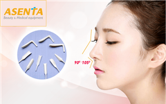 VẬT LIỆU NÂNG MŨI KEOSAN MISTI TB70-20