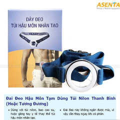 Dây Đeo Hậu Môn Nhân Tạo