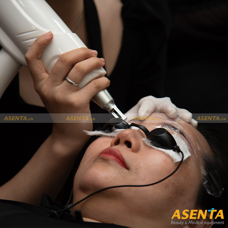 Máy Xóa Xăm Laser Mini ND Yag HMTR-2108