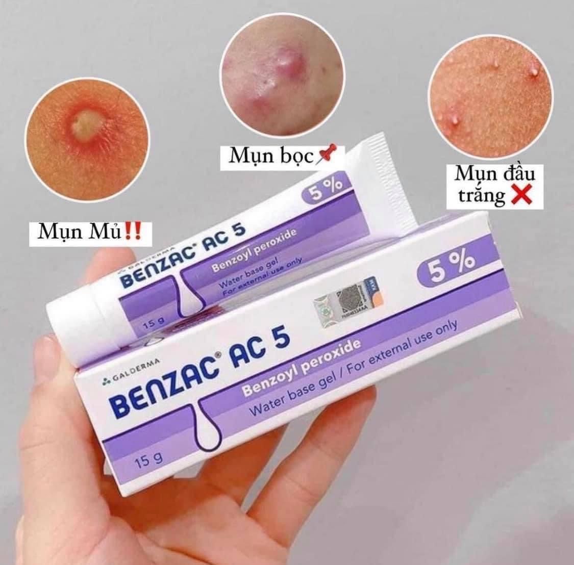  Kem Trị Mụn Galderma Benzac AC 5 5% 15g 