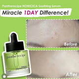 Serum Pestlo Pantherecipe Nonicica Soothing 30Ml