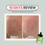 Serum Pestlo Pantherecipe Nonicica Soothing 30Ml