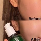 Serum Dr.G R.E.D Blemish Clear Soothing Active Essence 80ml