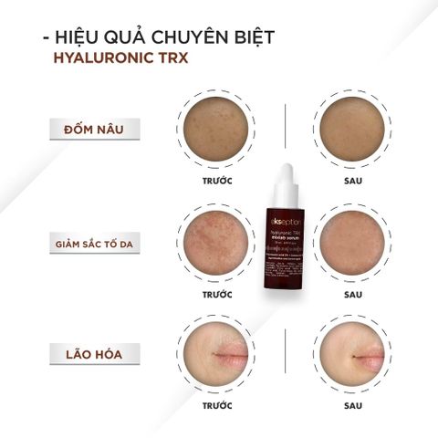 Serum Ekseption Hyaluronic Trx Mixlab 75Ml