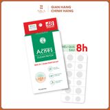 Miếng Dán Mụn Acnes Clear Patch 48M