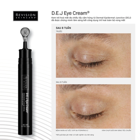 Kem Dưỡng Mắt Revision Skincare D-E-J Eye Cream 14G