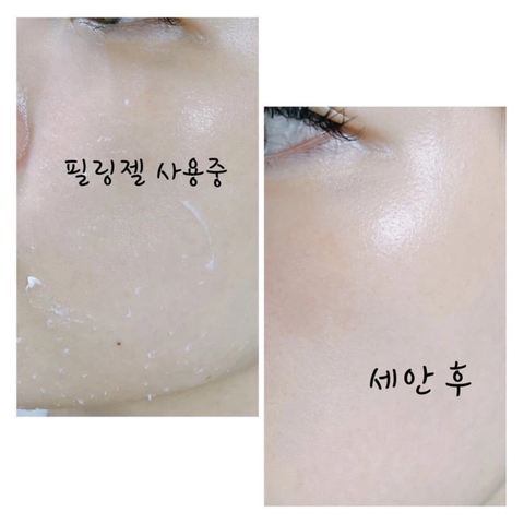 Tẩy Da Chết Thuần Chay Klavuu Phytoncide Peeling Gel 80ML