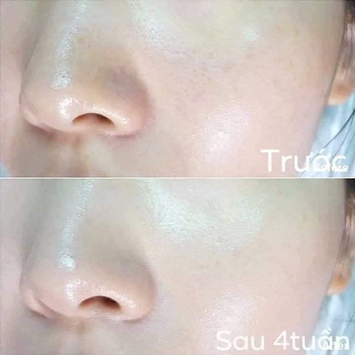 [SALE] Tinh Chất Tẩy Da Chết Dưỡng Trắng Su:m37 LosecSumma Elixir Treatment 150ml