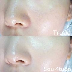 [SALE] Tinh Chất Tẩy Da Chết Dưỡng Trắng Su:m37 LosecSumma Elixir Treatment 150ml