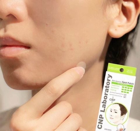 Miếng Dán Mụn CNP Laboratory Anti-Blemish Spot Patch (60 Miếng)