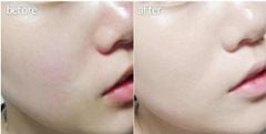 Nước Thần Su:m37 Secret Essence Advanced Fullsize 80ml