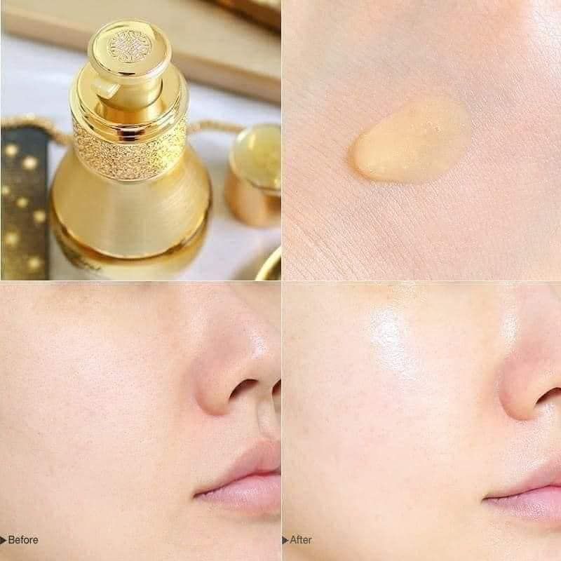 Tinh Chất Cân Bằng Hệ Vi Sinh Ohui The First Geniture Sym-Micro Essence 50ml