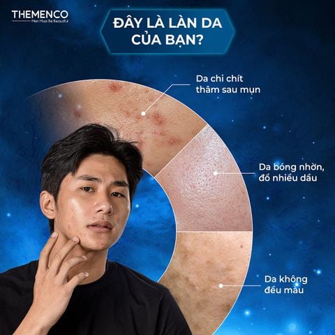 Serum hỗ trợ giúp giảm thâm sau mụn Lightening Serum 30ml Themenco