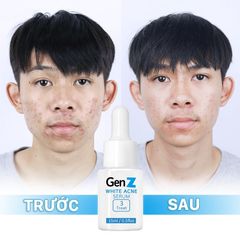 Serum Giảm Mụn Oriskin GenZ White Acne Serum Loại Bỏ Các Loại Mụn Viêm, Trứng Cá Và Mụn Đầu Đen 15ml