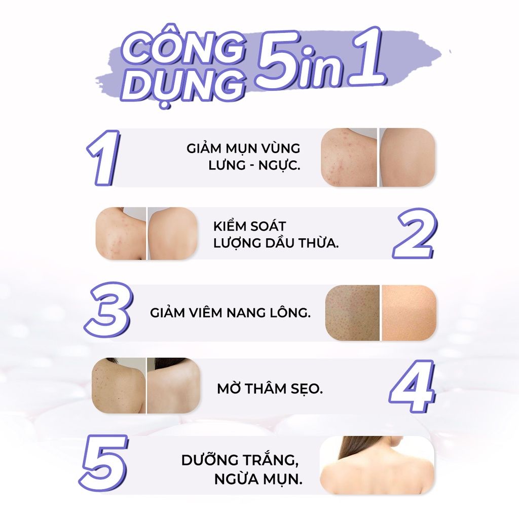 Xịt Mụn Lưng , Ngực , Giảm Mụn Sưng , Mụn Viêm , Mụn Trứng Cá , Giảm Viêm Nang Lông Nữ  Oriskin Vicenta Body Mist  100ml