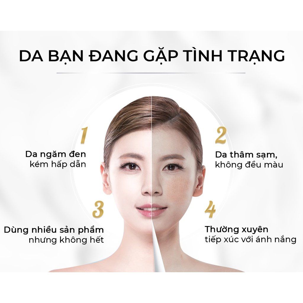 Kem Nám Tàn Nhang Oriskin Melasma & Whitening Cream Làm Mờ Nám Tàn Nhang Lâu Năm, 20ml