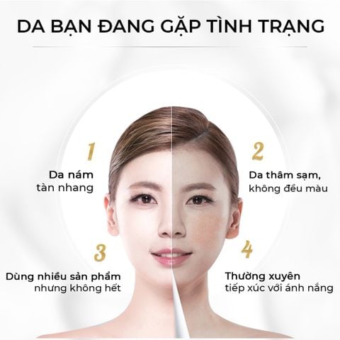 Bộ Kem Nám Tàn Nhang Dưỡng Trắng Mờ Thâm Kem Oriskin Melasma Whitening Cream 20ml Và Serum Oriskin White Skin Serum 30ml