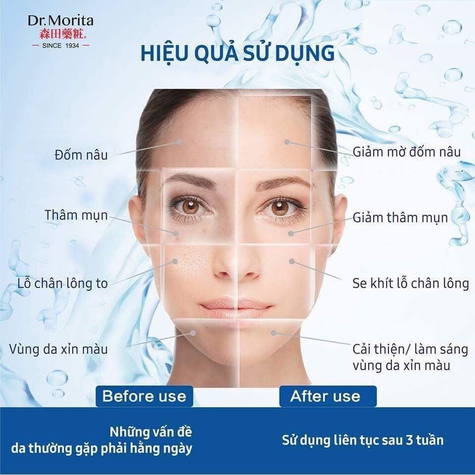 Mặt Nạ Dr.Morita Làm Dịu, Cải Thiện Lỗ Chân Lông To 30g Tea Tree & Licorice Pore Refining Facial Mask