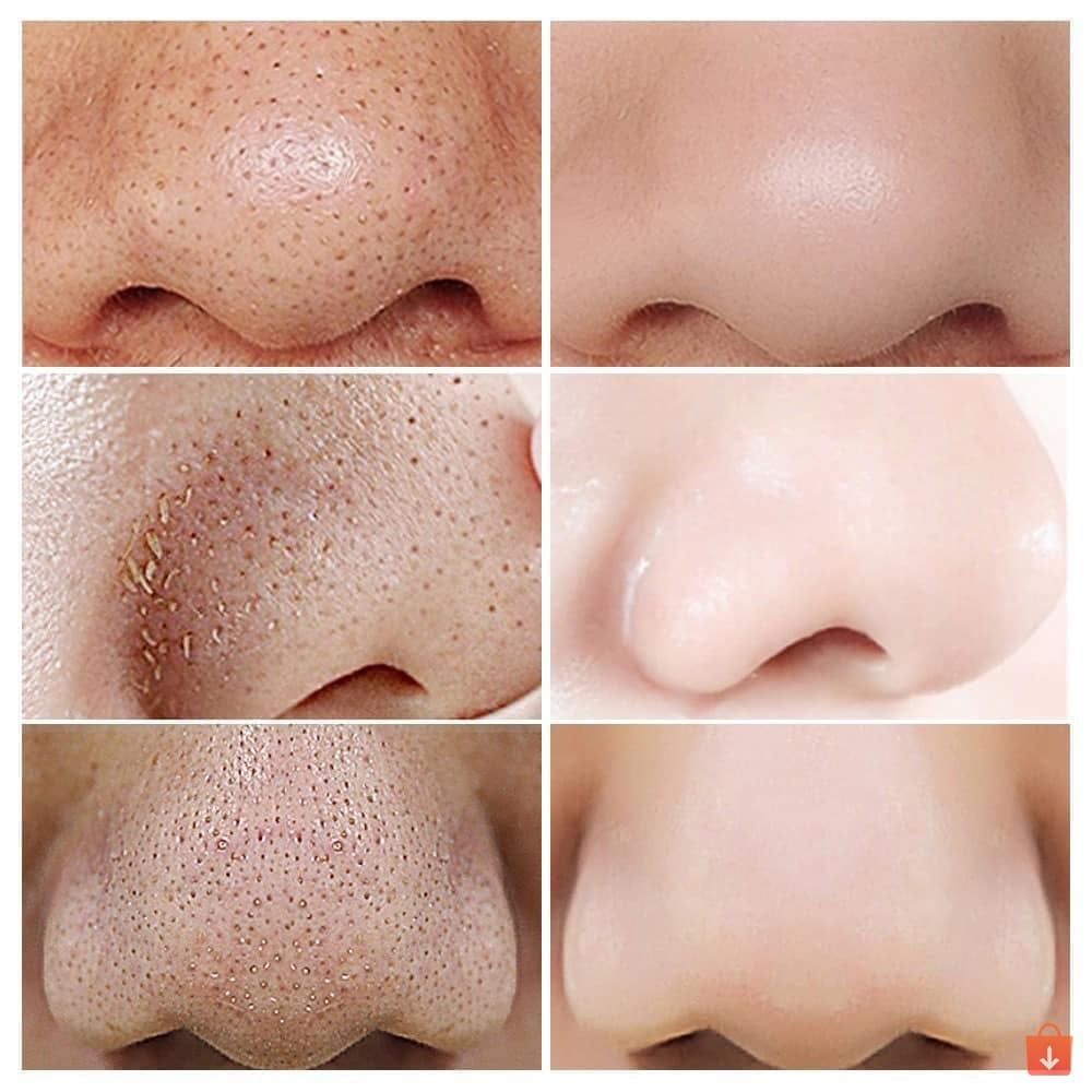 Toner Pad Tẩy Da Chết Neogen Dermalogy BHA, Cica, AHA, Niacinamide Dưỡng Ẩm Da, Se Khít Lỗ Chân Lông