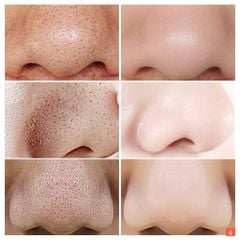 Toner Pad Tẩy Da Chết Neogen Dermalogy BHA, Cica, AHA, Niacinamide Dưỡng Ẩm Da, Se Khít Lỗ Chân Lông