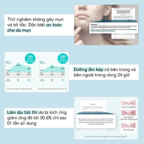 Kem Dưỡng Ẩm Beyond Angel Aqua Moisture Cream/Aqua Moisture Barrier Cream 150ml