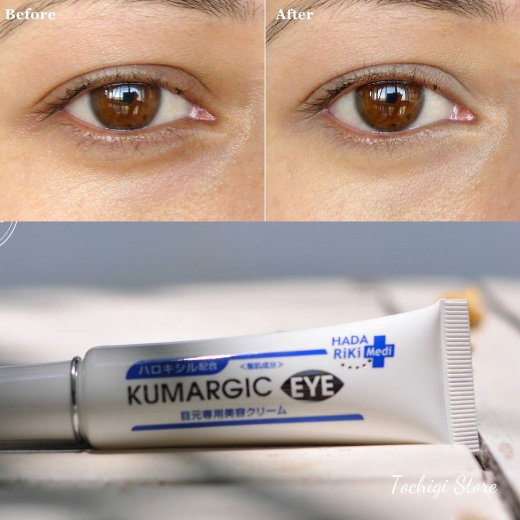 Kem ngăn ngừa thâm quầng mắt Kumargic Eye Nhật Bản 20g (Bản mới)