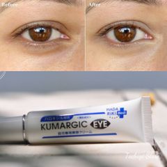 Kem ngăn ngừa thâm quầng mắt Kumargic Eye Nhật Bản 20g (Bản mới)