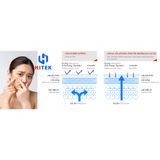  Thiết bị lọc nước vòi sen tắm Mitsubishi Cleansui ES101 