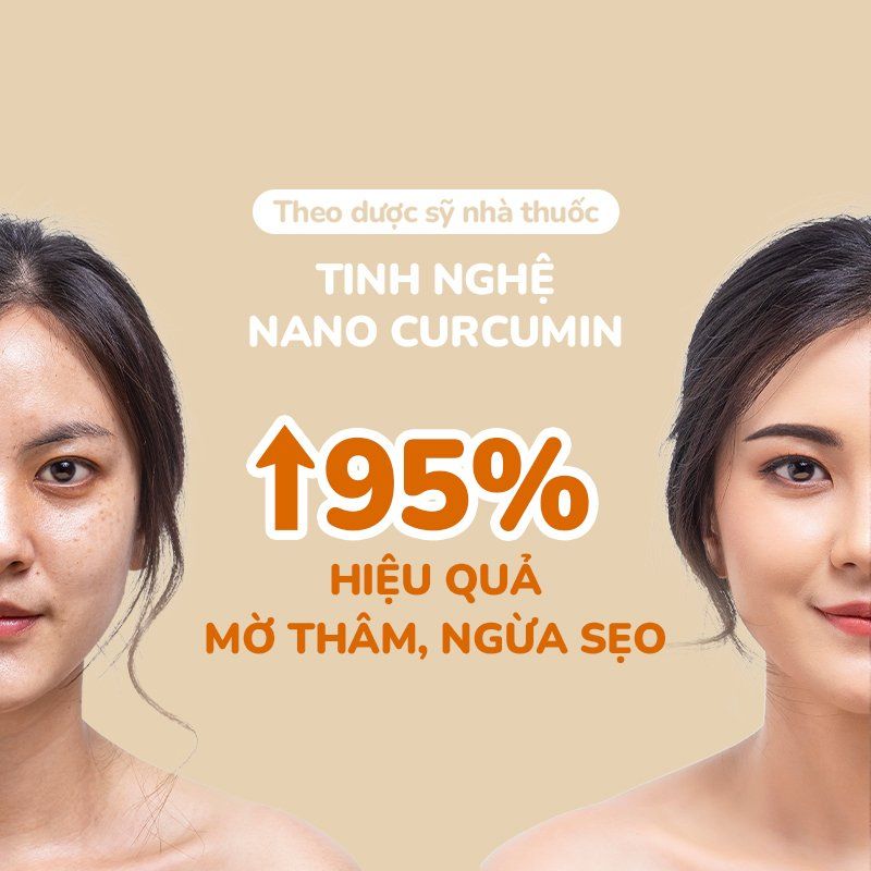 Bộ Đôi Giảm Nhờn Mụn Mờ Vết Thâm Gồm Sữa Rửa Mặt Nghệ NeoCleanser(86g) + Gel Nghệ Nano NeoCurma(20g)