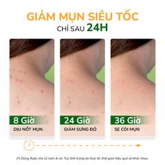 Xịt giảm mụn lưng, giảm thâm mụn, sạch mụn mờ thâm giảm viêm NeoAcnes 100ml