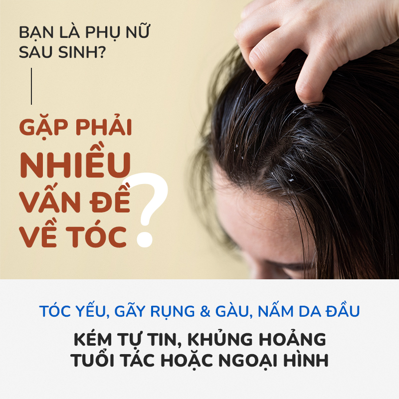 9 nguyên nhân rụng tóc nhiều ở nam giới  Hector