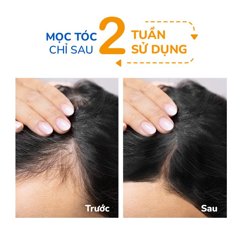 Bộ Đôi (Gội + Xịt Dưỡng) Giảm Rụng Hỗ trợ Mọc Tóc Gồm Dầu Gội Hoa Bưởi (250ml) & Serum Hoa Bưởi Neo Nature (50ml)