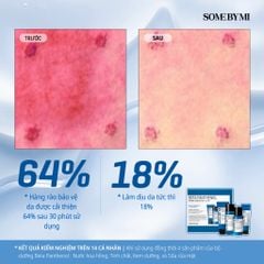 Some By Mi Bộ kit Beta Panthenol Repair Starter Kit (4 items)