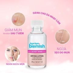 Bye bye Blemish Chấm mụn Drying Lotion 30ml